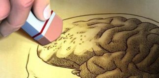 Alzheimer