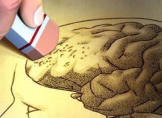 Alzheimer