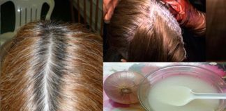 canas
