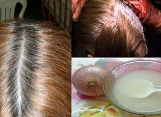 canas