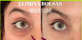 Ojeras