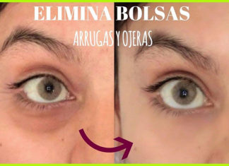 Ojeras