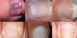 uñas