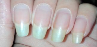 uñas
