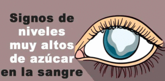 azúcar