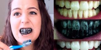 dientes