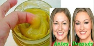 arrugas