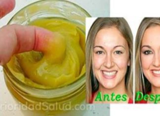 arrugas