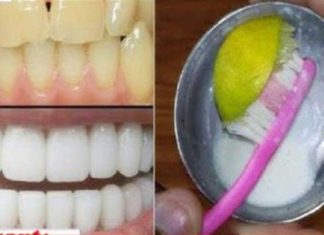 dientes amarillos