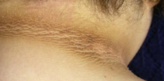 cuello